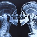 Чем отличается КТ от МРТ — основные различия и что лучше